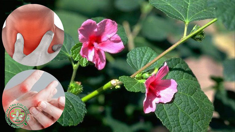 Trừ phong, giảm đau nhức xương khớp 1