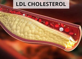 3. Cholesterol cao 1