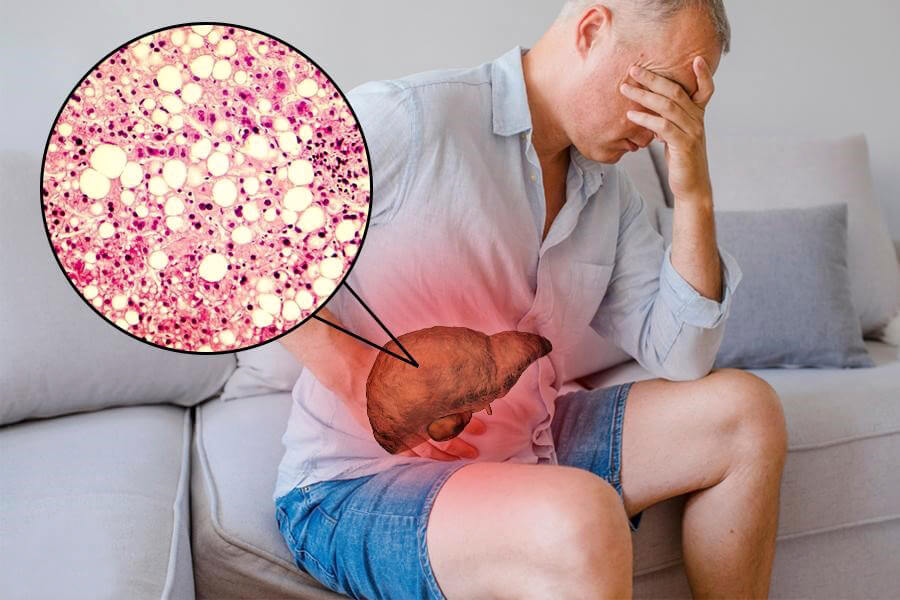 Top 5 thảo dược giúp hạ men gan cực tốt không thể bỏ qua 1 Top 5 thảo dược giúp hạ men gan cực tốt không thể bỏ qua 1