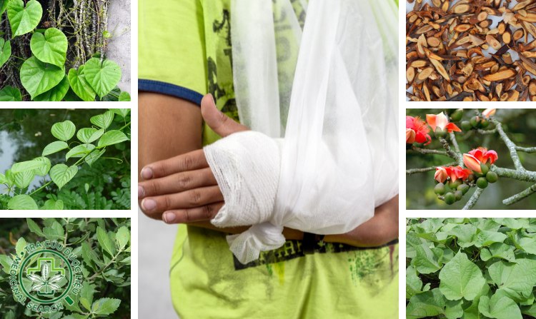 3.5. Bài thuốc 5 giúp liền xương nhanh chóng 1 3.5. Bài thuốc 5 giúp liền xương nhanh chóng 1