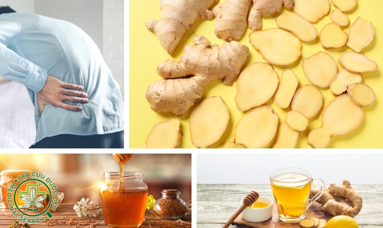 2.1. Bài thuốc 1 chữa thoát vị đĩa đệm bằng gừng 1 2.1. Bài thuốc 1 chữa thoát vị đĩa đệm bằng gừng 1