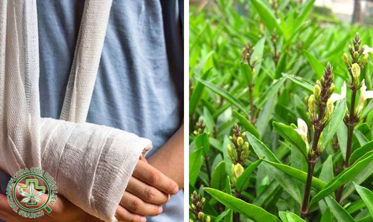 3.3. Bài thuốc 3 chữa gãy xương kín bằng cây thanh táo 1 3.3. Bài thuốc 3 chữa gãy xương kín bằng cây thanh táo 1