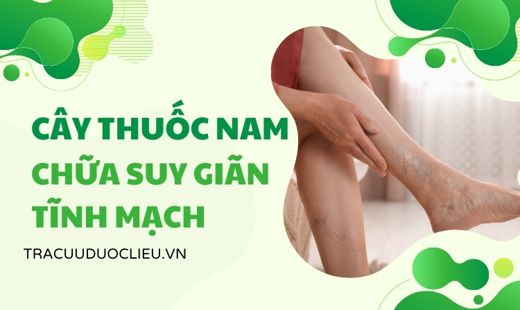 4 cây thuốc nam chữa suy giãn tĩnh mạch dễ kiếm 1 4 cây thuốc nam chữa suy giãn tĩnh mạch dễ kiếm 1