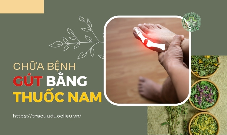 Chữa bệnh gút hiệu quả bằng các bài thuốc nam dễ tìm 1 Chữa bệnh gút hiệu quả bằng các bài thuốc nam dễ tìm 1