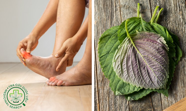 2.1. Chữa bệnh gút bằng lá tía tô 1 2.1. Chữa bệnh gút bằng lá tía tô 1