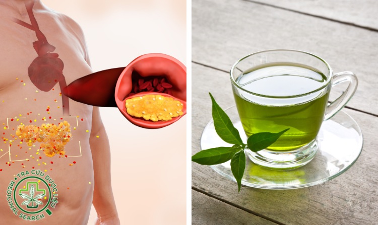2.1. Cây trà xanh giúp chữa bệnh máu nhiễm mỡ 1 2.1. Cây trà xanh giúp chữa bệnh máu nhiễm mỡ 1