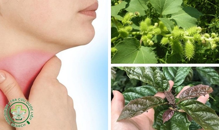 2.1. Chữa bướu cổ bằng quả ké đầu ngựa và cây xạ đen 1 2.1. Chữa bướu cổ bằng quả ké đầu ngựa và cây xạ đen 1