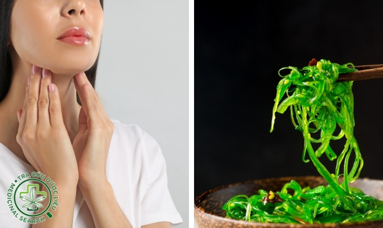 2.2. Chữa bướu cổ bằng hải tảo (rong biển) 1 2.2. Chữa bướu cổ bằng hải tảo (rong biển) 1