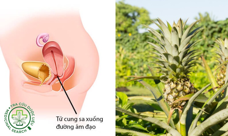 2.1. Chữa sa tử cung bằng cây dứa dại 1