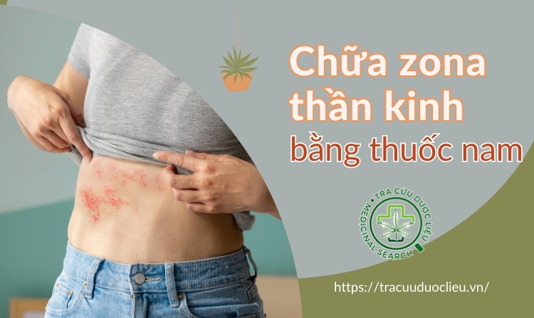 7 cách chữa zona thần kinh bằng thuốc nam hiệu quả 1 7 cách chữa zona thần kinh bằng thuốc nam hiệu quả 1