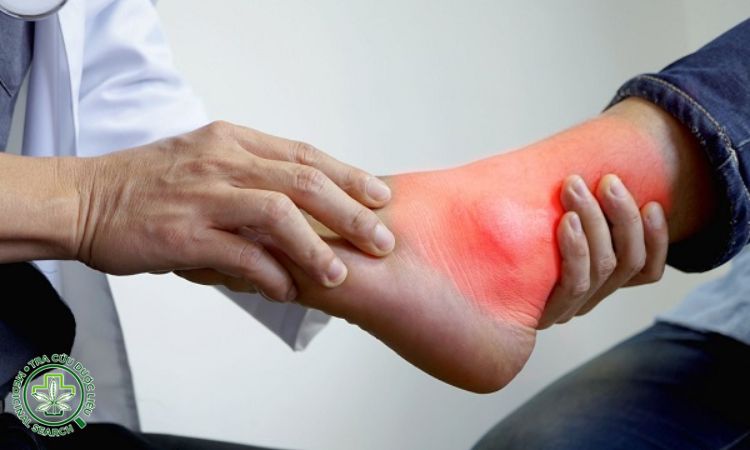 Cây mật nhân nấu nước uống điều trị bệnh gout 1