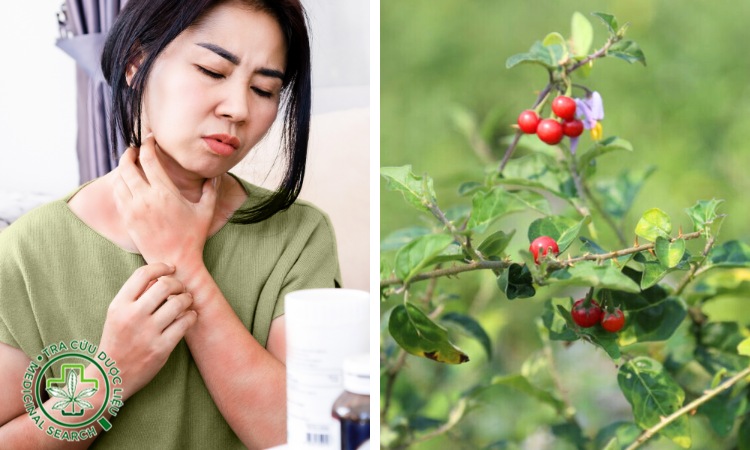 1.3. Do dị ứng với cà gai leo 1 1.3. Do dị ứng với cà gai leo 1