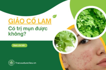 Giảo cổ lam trị mụn – hiệu quả đến đâu?