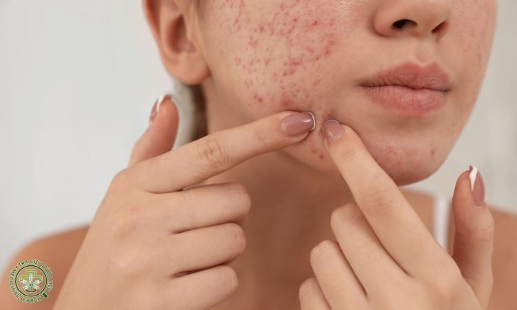 Thanh nhiệt, giải độc, trị vàng da và mụn nhọt 1